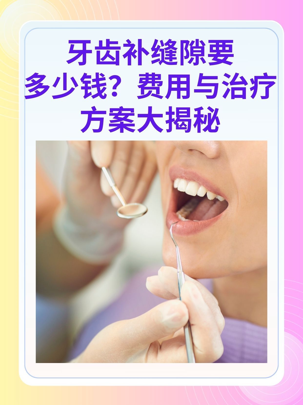 镇江补牙医保可以报销吗(补牙医保可以报销吗 哪些可以报销呢)